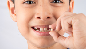 Как выпадают молочные зубы ?