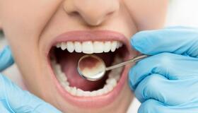 Как предотвратить кариес зубов