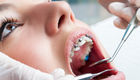 Как проходит имплантация зуба?