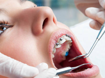 Как проходит имплантация зуба?